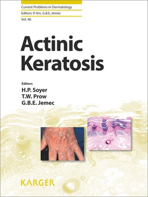 cover image of Actinic Keratosis